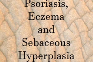 Home Remedies for Psoriasis, Eczema and Sebaceous Hyperplasia at www.lovehomeandhealth.com