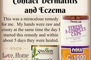 contact dermatitis treatment - Love, Home and Health